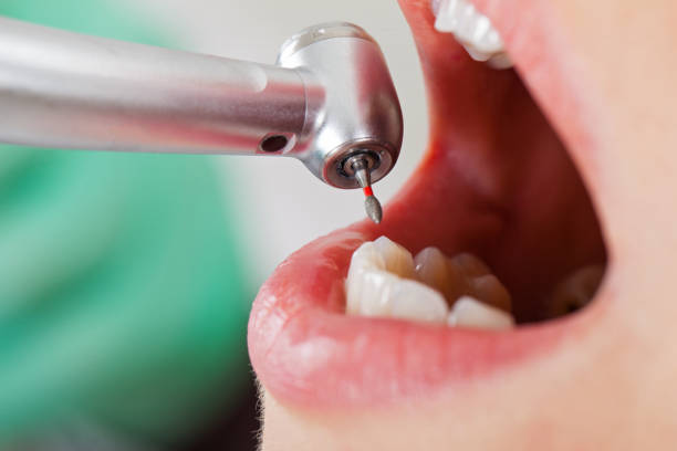 Best Broken Tooth Emergency  in Baiting Hollow, NY